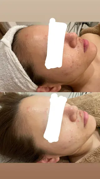 メナードフェイシャルサロン　片町所属・メナードフェイシャル サロン片町店ハタケのエステ・リラクイメージ