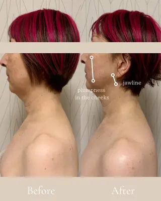 Lani Moon所属・⟡ 京都 小顔  ⊹ Lani Moonのエステ・リラクイメージ