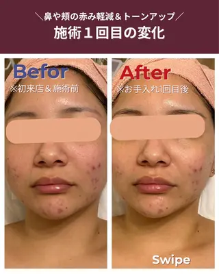 肌質改善エステRISMIN所属・肌質改善エステ RISMINのエステ・リラクイメージ