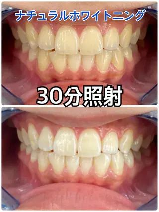 Platinum Beauty 四条烏丸店所属・吉田亮利 ホワイトニング専門店のその他イメージ