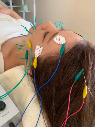 新宿hari-me所属・美容鍼hari-me 新宿のエステ・リラクイメージ