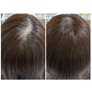 肌質改善Charme coco  増毛のエステ・リラクイメージ