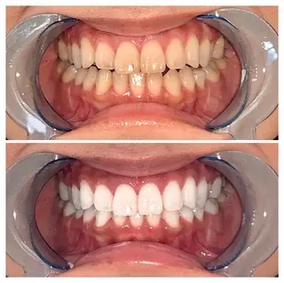 メンズ ライトビューティー 錦糸町店のエステ・リラクイメージ