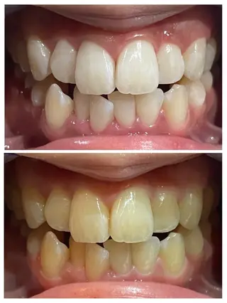 サクッとホワイト所属・セルフホワイトニング サクホワ五反田店のその他イメージ