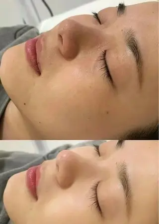 マツエク・マツパ aliaハイフ&水光ジェットサロン所属・aliaハーブ水光店 エステティシャン募集のエステ・リラクイメージ