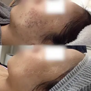 ミディアム カラー パーマ ネイル マツエク・マツパ アイブロウ 都度払い肌質改善 &脱毛Blancheのエステ・リラクイメージ