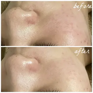 メンズ メナード岐阜市茜部 杉浦のエステ・リラクイメージ