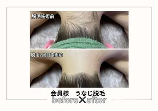 みんなの脱毛ツルリン ☀️船橋店☀️のエステ・リラクイメージ