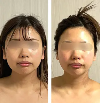 SOLUNA目黒店所属・小顔/毛穴洗浄/痩身 ayako🌿のエステ・リラクイメージ