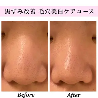 Bellesthe （ベルエステ）のエステ・リラクイメージ