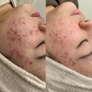 エステサロンTug 高知駅前店のエステ・リラクイメージ