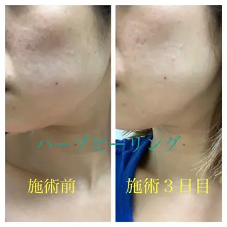 ショート カラー パーマ ヘアアレンジ キッズ ネイル マツエク・マツパ エステティック Nanagiのエステ・リラクイメージ