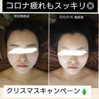 Jeliss~美爪育成ネイル＆頭蓋骨小顔矯正サロン~所属・美顔(小顔)矯正& 美爪育成Jelissのエステ・リラクイメージ