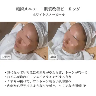 Plus One Beauty所属・【新大阪】痩身/小顔 美肌フェイシャルのエステ・リラクイメージ