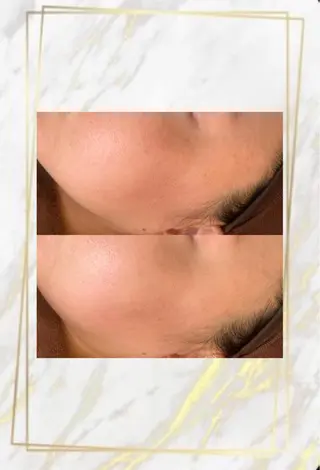 ハーブピーリング特選 認定rebirthのエステ・リラクイメージ