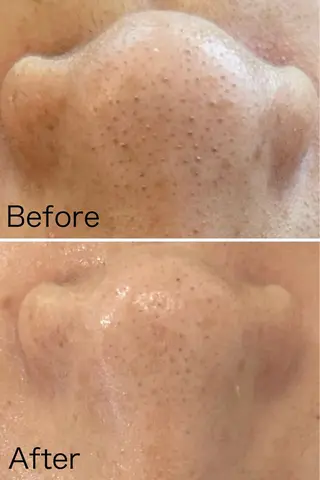 美時雨・bishigure所属・美時雨 bishigureのエステ・リラクイメージ