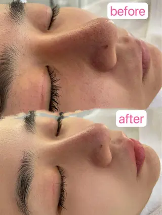 毛穴洗浄& 睫毛パーマ上野御徒町のマツエク・マツパデザイン