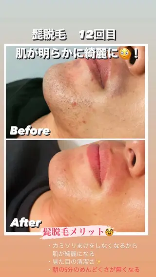 メンズ I'iris所属・【脱毛サロン iiris】占い可のエステ・リラクイメージ