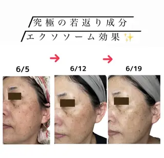 stella所属・stella都度払い 痩身小顔まつげパーマのマツエク・マツパデザイン