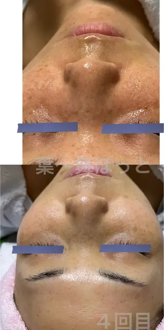 うえつま ふみえのエステ・リラクイメージ