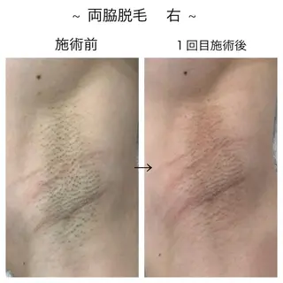 ビューティー ミロワールのエステ・リラクイメージ