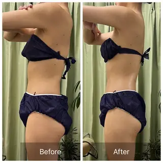 【元に戻らない】 小顔&部分痩せのその他イメージ