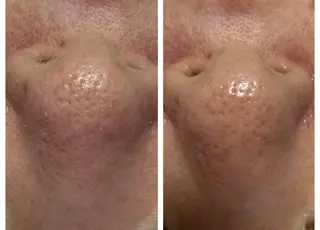 LUCIALL  ルシアル所属・児玉 愛由美のエステ・リラクイメージ