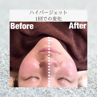 ゆか/エステサロン Lilasmileのエステ・リラクイメージ