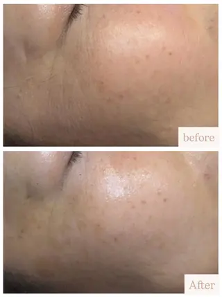 uni. abeのエステ・リラクイメージ