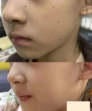 ビューティーリゾート麗所属・于 麗影のエステ・リラクイメージ