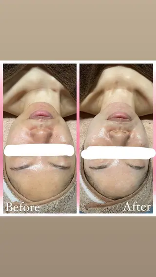 salon〜RePCa〜(サロンルピカ)所属・山﨑 藍のエステ・リラクイメージ