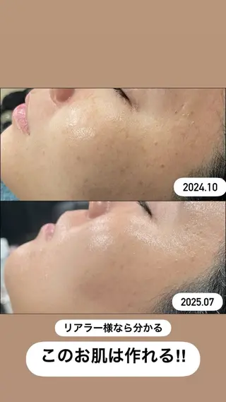 LiZA エステティックサロンのエステ・リラクイメージ