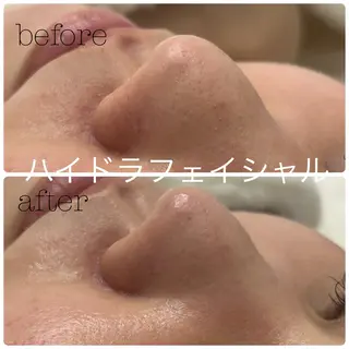 フェイシャルサロン CHIARA 荒田のエステ・リラクイメージ