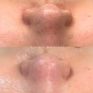 WONA所属・Yamada Rのエステ・リラクイメージ