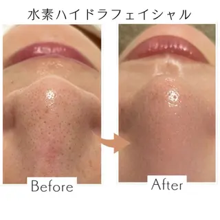 プライベートサロン Belle(ベル)のエステ・リラクイメージ