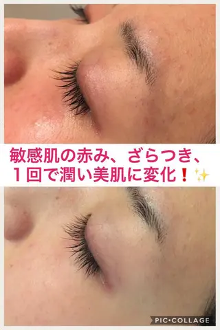 ミディアム カラー パーマ ヘアアレンジ メンズ キッズ ネイル マツエク・マツパ ニキビ・肌質改善専門 ♡人生が変わるサロンのエステ・リラクイメージ