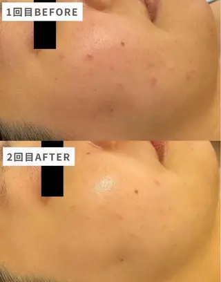 lapeca〜ラペカ〜所属・肌ケアサロン🌿 lapeca 土井のエステ・リラクイメージ