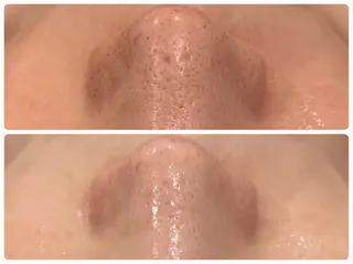 通うほど変わる本格 エステ心斎橋REVIのエステ・リラクイメージ