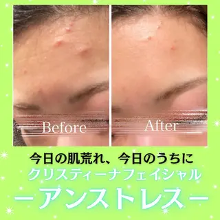 痩身&美肌サロン 遠藤🍊のエステ・リラクイメージ