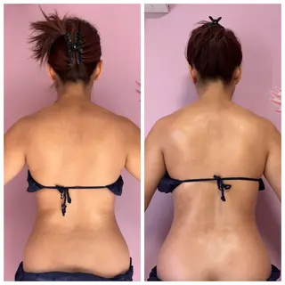 ビューティーサロンパピヨン所属・小林 沙英のエステ・リラクイメージ