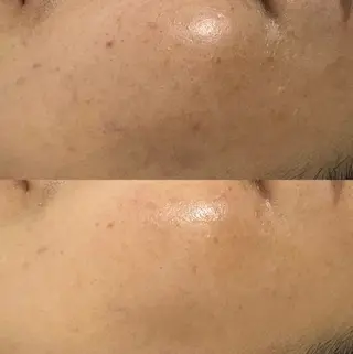 南森町・肌質改善 BELMIMARのエステ・リラクイメージ