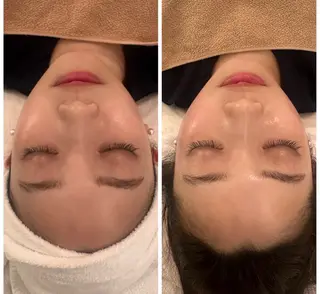 レセラ銀座所属・レセラ 銀座のエステ・リラクイメージ