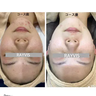 レイビス八戸店 野口のエステ・リラクイメージ