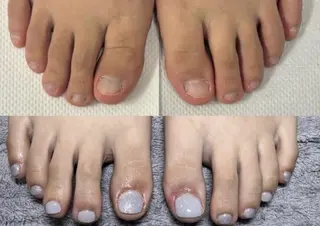 ネイル 深爪矯正専門サロン　ルソア所属・深爪矯正専門サロン ルソアのネイルデザイン