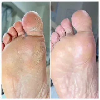 脱毛&エステ GLG 徳並のエステ・リラクイメージ