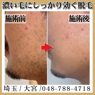 脱毛＆フェイシャル TOWA大宮のエステ・リラクイメージ