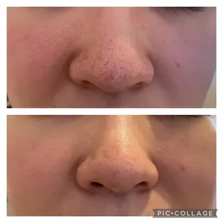 栄養エステ And Pielのエステ・リラクイメージ