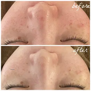 メンズ メナード岐阜市茜部 杉浦のエステ・リラクイメージ