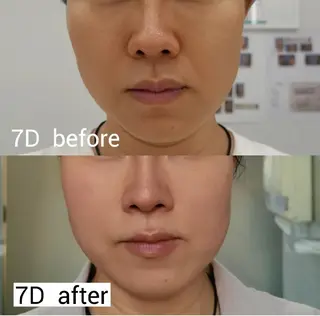 aliaハイフ&水光ジェットサロン所属・aliaハーブ水光店 エステティシャン募集のエステ・リラクイメージ