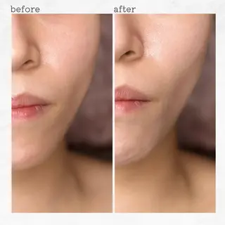 眉とお肌の専門サロン RioL / Aiのエステ・リラクイメージ